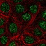 KLLN Antibody in Immunocytochemistry (ICC/IF)