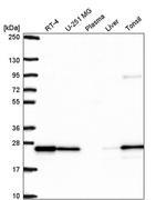 RAB8B Polyclonal Antibody