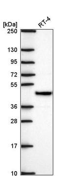 SURF6 Antibody in Western Blot (WB)