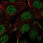 C11orf71 Polyclonal Antibody