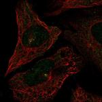 CEP72 Polyclonal Antibody