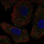 GALNT9 Polyclonal Antibody