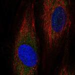 ASNSD1 Polyclonal Antibody