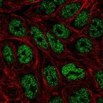 ZNF45 Polyclonal Antibody