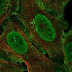 ZCCHC5 Polyclonal Antibody