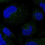 SMIM3 Polyclonal Antibody