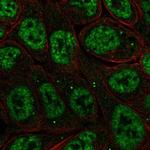 IkB zeta Polyclonal Antibody