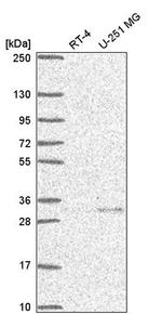 UCH37 Antibody in Western Blot (WB)