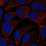 ST7L Polyclonal Antibody
