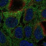 MOCS1 Polyclonal Antibody