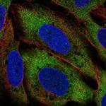 CIT Polyclonal Antibody