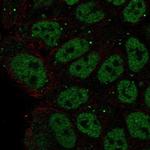 ZNF585B Polyclonal Antibody