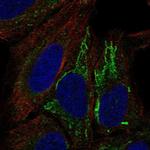 MT-ND4L Polyclonal Antibody