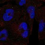 CLTCL1 Polyclonal Antibody