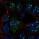 LRRN4 Polyclonal Antibody