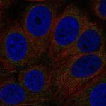 GPR89A Polyclonal Antibody