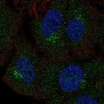 GALNT4 Polyclonal Antibody