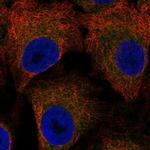 LSAMP Polyclonal Antibody