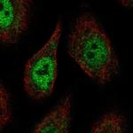 PCDHAC2 Antibody in Immunocytochemistry (ICC/IF)