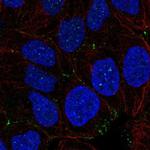 NHS Polyclonal Antibody