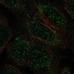 TCEAL2 Polyclonal Antibody