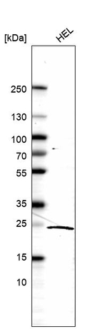 KLRG1 Antibody in Western Blot (WB)