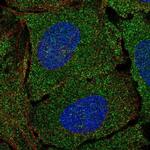 Mgea5 Polyclonal Antibody
