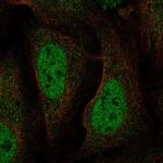 BAAT1 Polyclonal Antibody