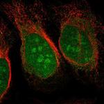 CHD3 Polyclonal Antibody