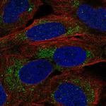 A4GALT Polyclonal Antibody