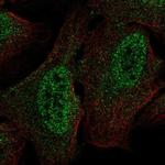 CSDC2 Polyclonal Antibody