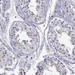 DUSP15 Antibody in Immunohistochemistry (IHC)
