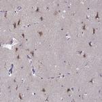 LRFN2 Antibody in Immunohistochemistry (IHC)