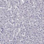 LRFN2 Antibody in Immunohistochemistry (IHC)