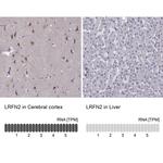 LRFN2 Antibody