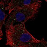 mPR gamma Polyclonal Antibody