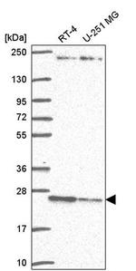 TMED3 Antibody in Western Blot (WB)