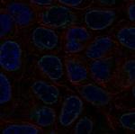 MAN1 Polyclonal Antibody