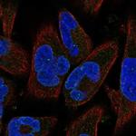 SYNE3 Polyclonal Antibody
