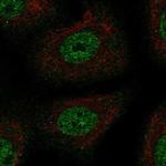 TSC22D1 Antibody in Immunocytochemistry (ICC/IF)