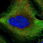 RPL36A Polyclonal Antibody