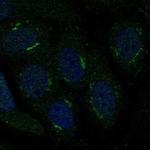 TMBIM4 Polyclonal Antibody