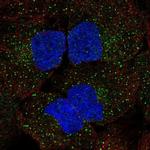 WNK3 Polyclonal Antibody
