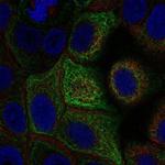 Adenylate Cyclase 5 Polyclonal Antibody