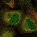 CK2 alpha-2 Polyclonal Antibody