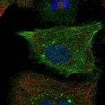 RND1 Polyclonal Antibody