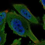 AMPK gamma-1 Polyclonal Antibody