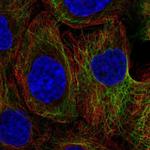 KRT80 Polyclonal Antibody