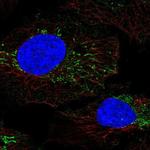 DMGDH Polyclonal Antibody