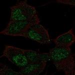 TCF9 Polyclonal Antibody